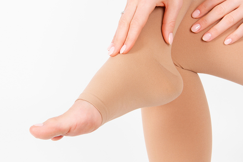 varicose veins pregnancy
