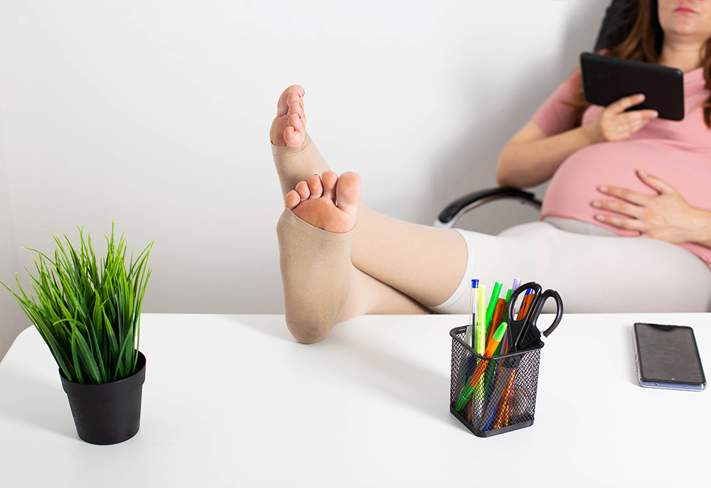 varicose veins pregnancy