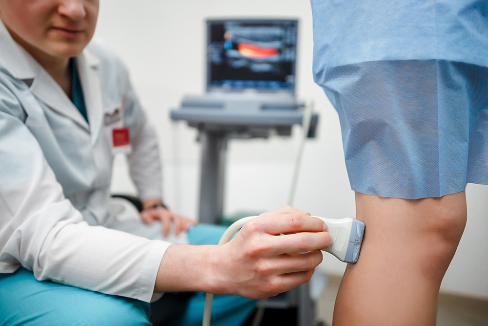 spider veins vs varicose veins modern treatments minimally invasive restore proper blood flow